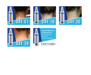 Animated 300x250 Banner for Dermatic Probiotic Skin Care | Banner-Design von Sergio Coelho