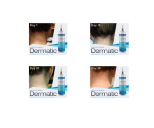 Animated 300x250 Banner for Dermatic Probiotic Skin Care | Banner-Design von Anthony