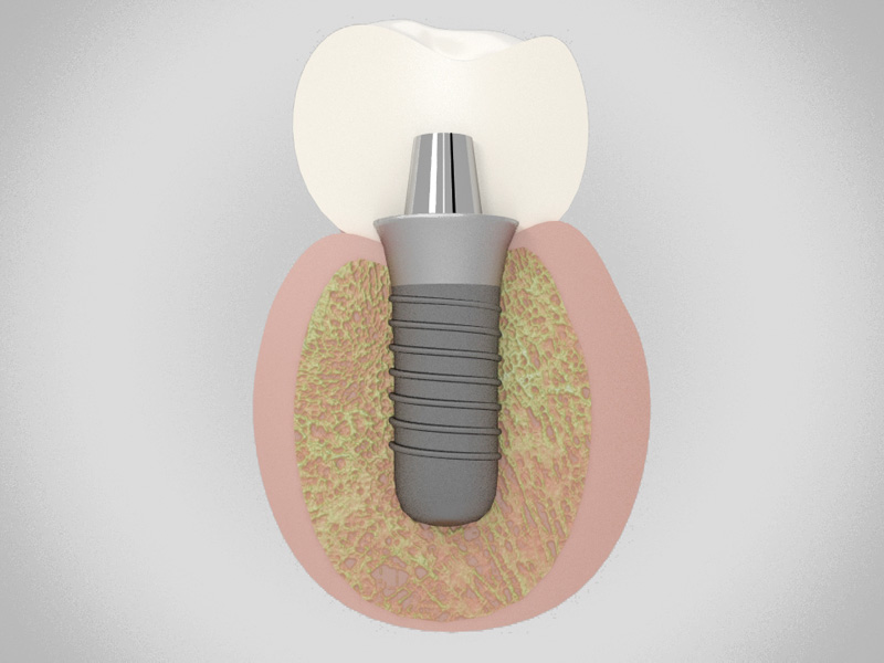 3D Design von Tori33 für Biotem | Design #2075972
