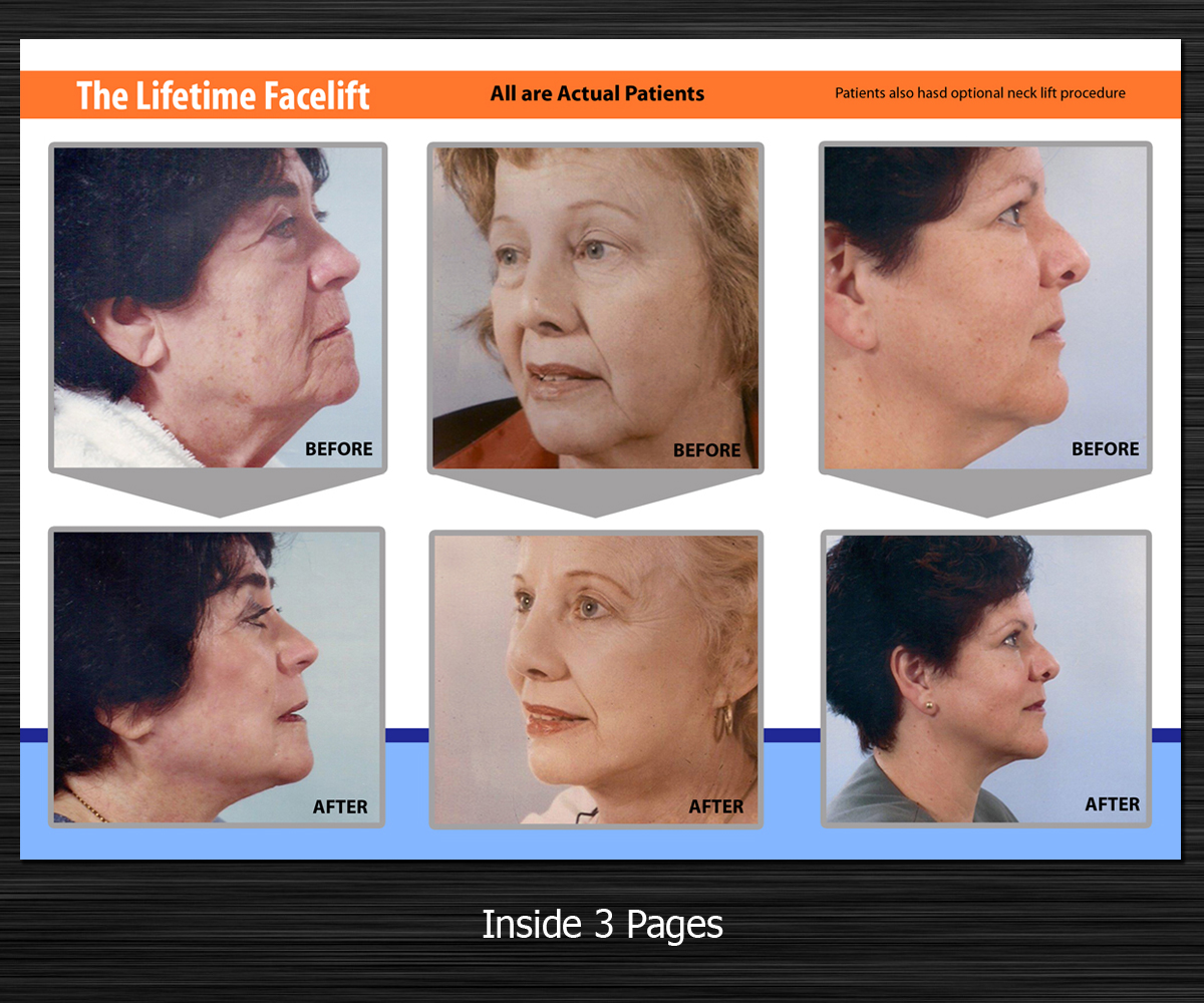 Brochure Design by Rflames for Web Moxie | Design #2136852