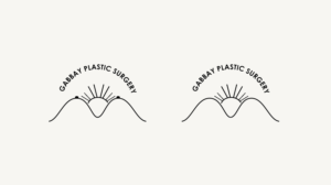 Illustration-Design von ColorDrops für Gabbay Plastic Surgery | Design: #10529314