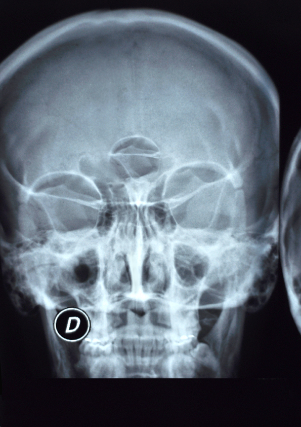 Photoshop Design by movingdiseno for DesignCrowd (Community Contests) | Design #11388371