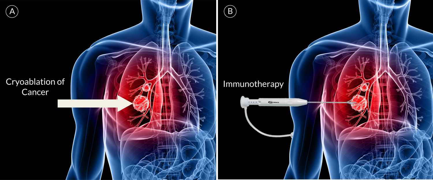 Illustration Design by J. Chaturvedi for Cancer Immune Biologics, LLC | Design #11560188