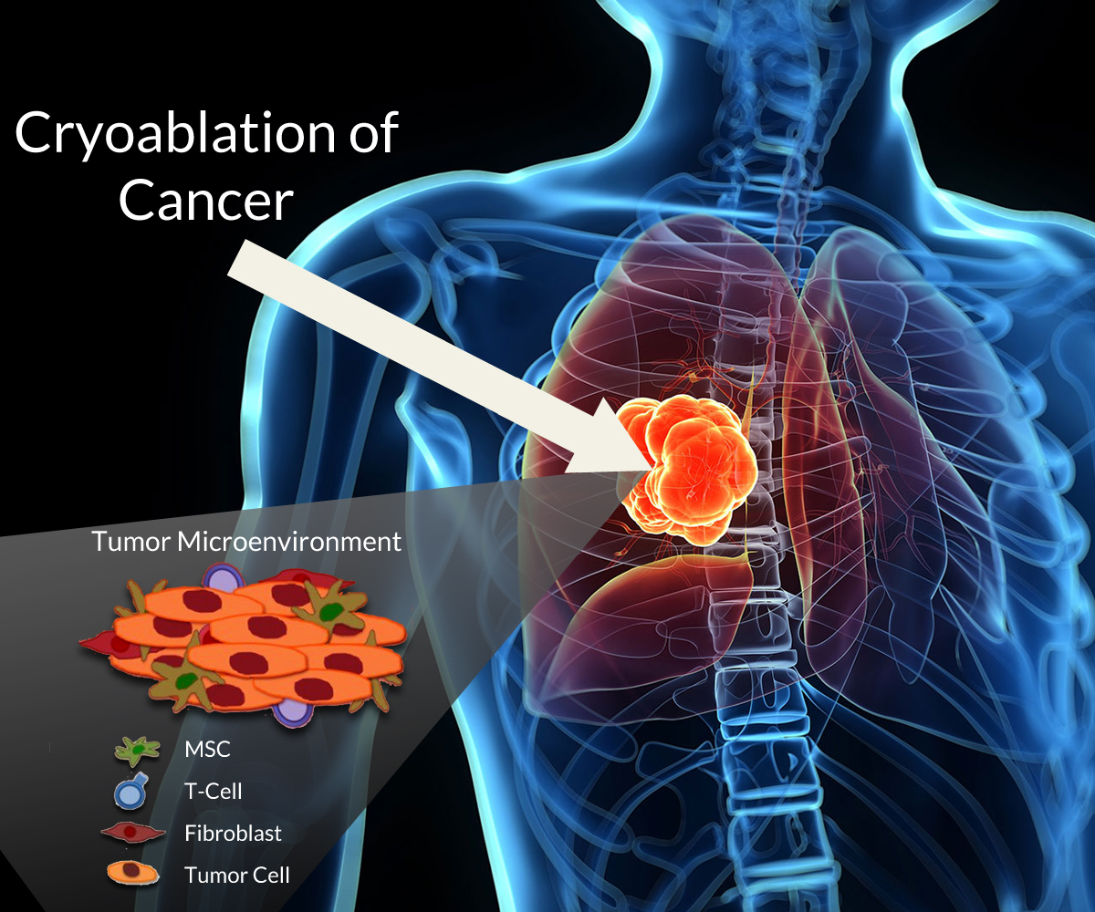 Illustration-Design von J. Chaturvedi für Cancer Immune Biologics, LLC | Design #11560369