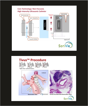 PowerPoint Design by wchristia for SoniVie | Design #12439833