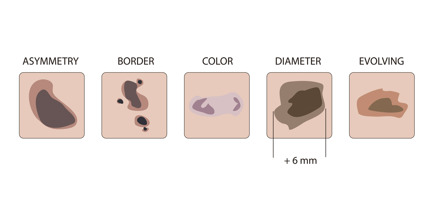 Diseño Con Ilustración por nanocb72 para University of utah | Diseño #14344133