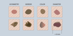 Illustration-Design von nanocb72 für University of utah | Design: #14463493