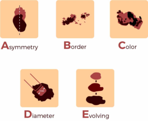 Diseño Con Ilustración por GliderGraphx para University of utah | Diseño: #14395483