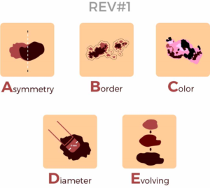 Diseño Con Ilustración por GliderGraphx para University of utah | Diseño: #14408599