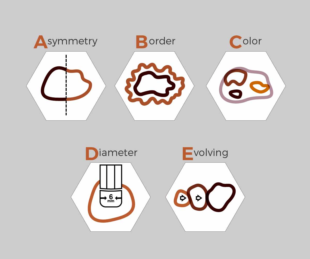 Diseño Con Ilustración por GliderGraphx para University of utah | Diseño #14409801