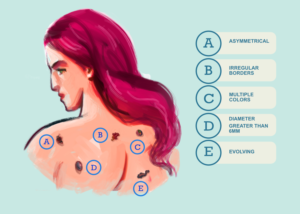 Illustration Design by artistraman for University of utah | Design: #14420397