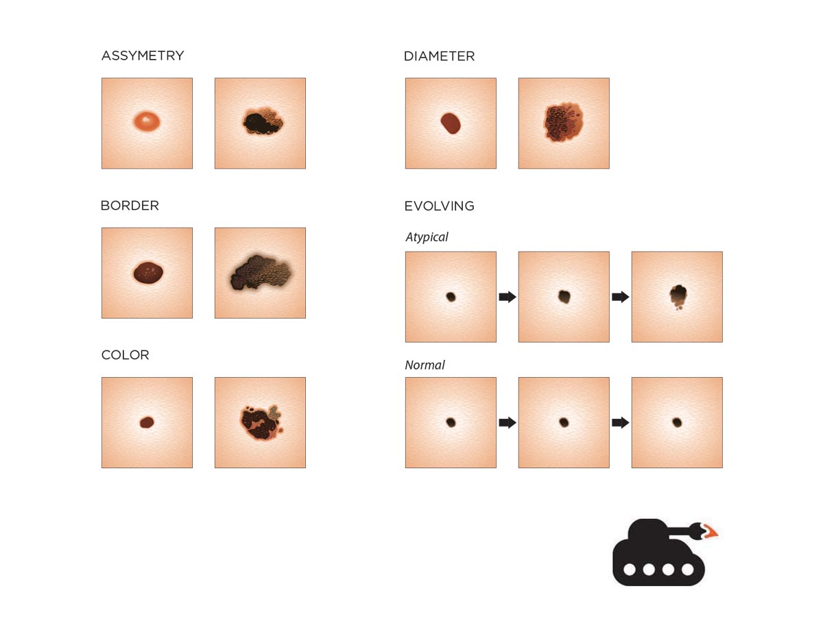 Diseño Con Ilustración por ArtTank para University of utah | Diseño #14380432