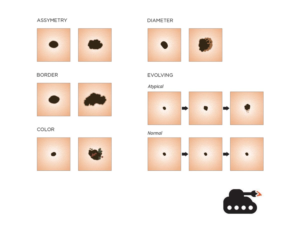 Diseño Con Ilustración por ArtTank para University of utah | Diseño: #14380450