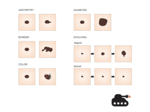 Diseño Con Ilustración por ArtTank para University of utah | Diseño: #14380714