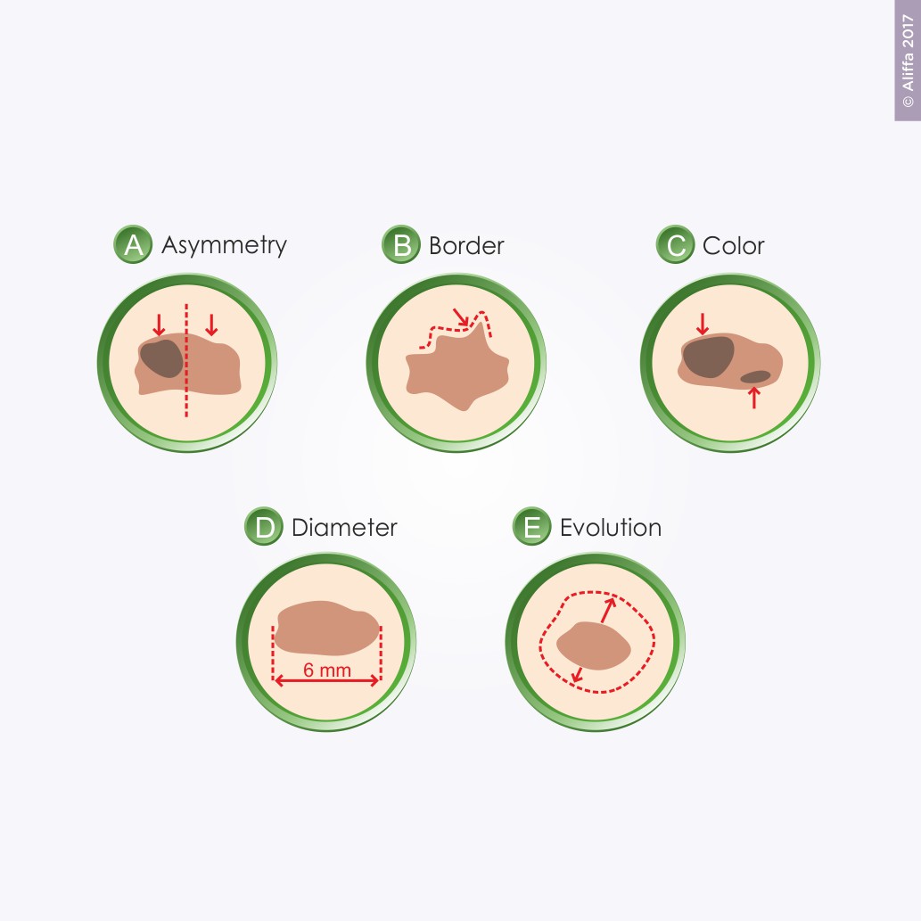 Diseño Con Ilustración por Aliffa para University of utah | Diseño #14443398