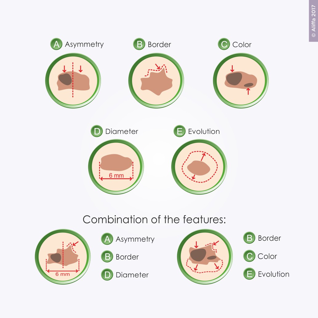 Illustration Design by Aliffa for University of utah | Design #14447962