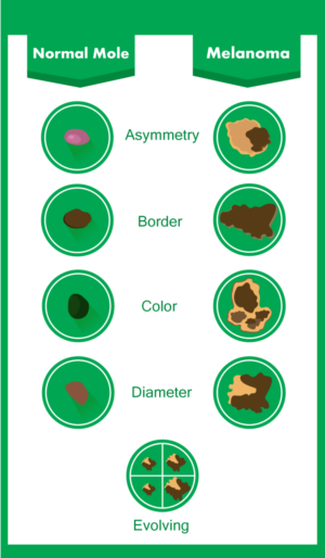 Diseño Con Ilustración por Pudja Pratama Sakti para University of utah | Diseño: #14382341