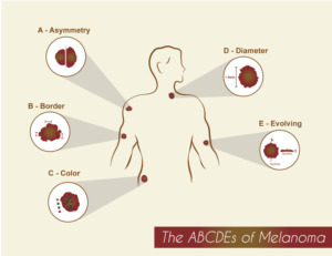 Illustration-Design von MAK45 für University of utah | Design: #14490359