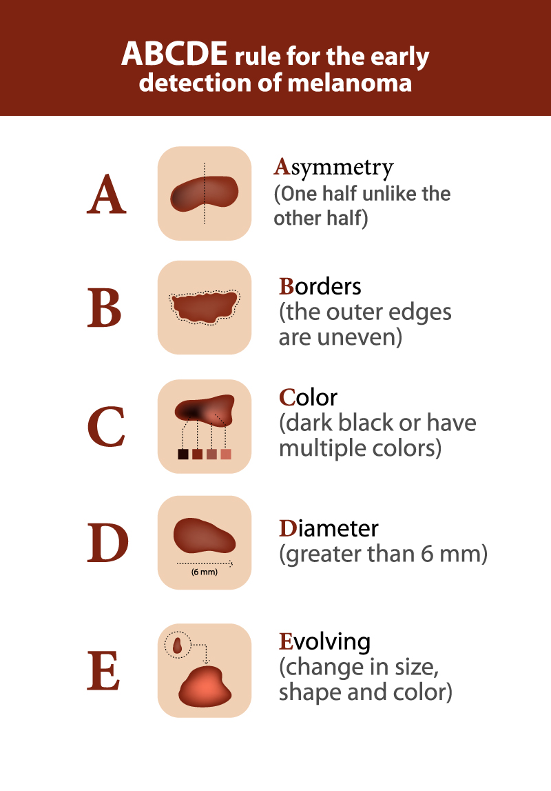 Illustration-Design von artexalt für University of utah | Design #14487073