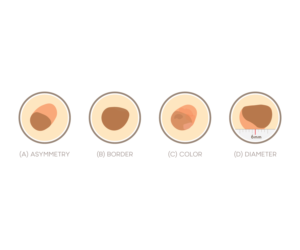 Illustration Design by Creati Studio
