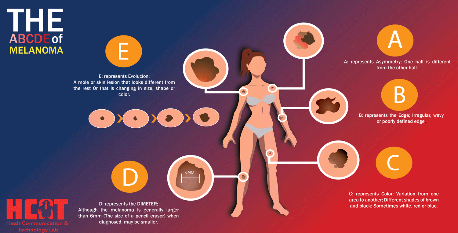 Diseño Con Ilustración por Jesus Martinez para University of utah | Diseño #14417359