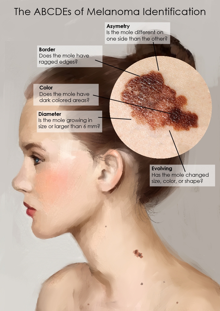 Diseño Con Ilustración por sdrum para University of utah | Diseño #14416202