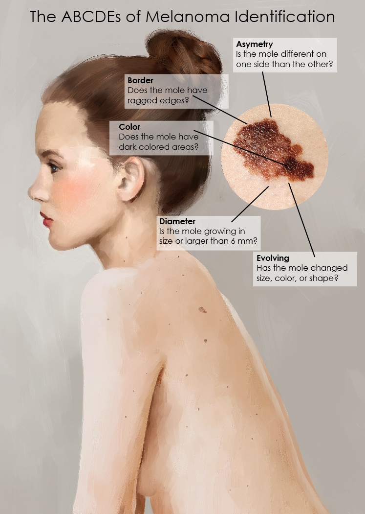 Illustration Design by sdrum for University of utah | Design #14428509