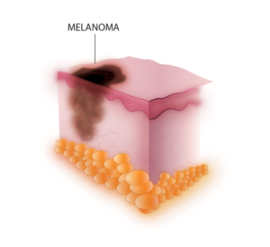 Illustration-Design von nafizrahat für University of utah | Design: #14366267