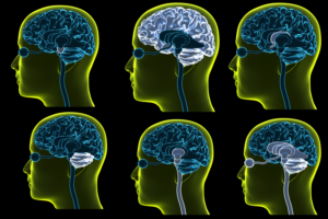 Brochure Design by Kwasi for iHealthcare Victoria Inc. | Design: #16249401