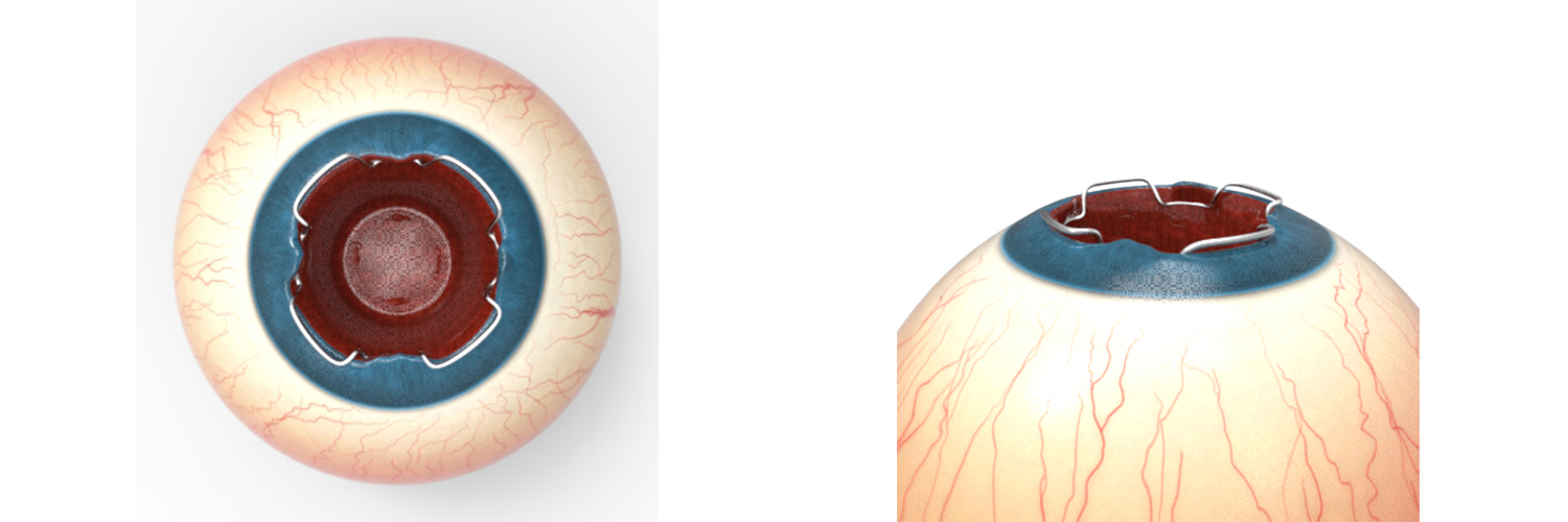 Diseño Con Ilustración por Kwasi para Diamatrix | Diseño #16174935