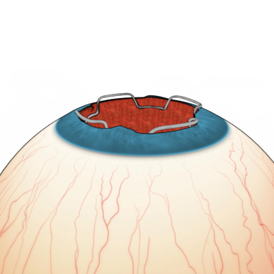 Diseño Con Ilustración por Kwasi para Diamatrix | Diseño #16175070