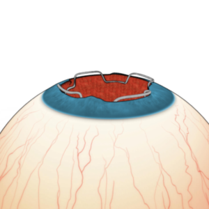 Diseño Con Ilustración por Kwasi para Diamatrix | Diseño: #16175070