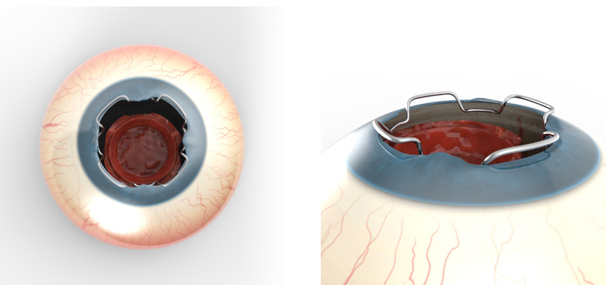 Illustration Design by Kwasi for Diamatrix | Design #16226981