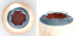 Diseño Con Ilustración por Kwasi para Diamatrix | Diseño: #16232323