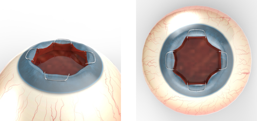Diseño Con Ilustración por Kwasi para Diamatrix | Diseño #16233517