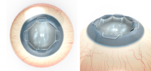 Diseño Con Ilustración por Kwasi para Diamatrix | Diseño: #16236355