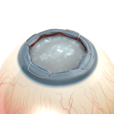 Diseño Con Ilustración por Kwasi para Diamatrix | Diseño #16249312