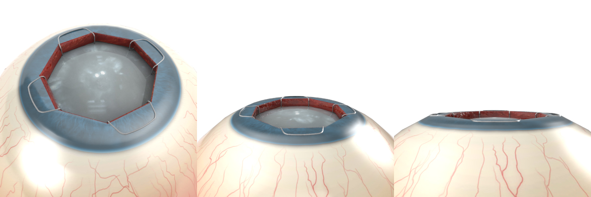 Illustration Design by Kwasi for Diamatrix | Design #16257902