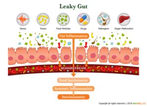 NutriAlly Leaky Gut Illustration | Illustration Design by SofiaDesignStudio