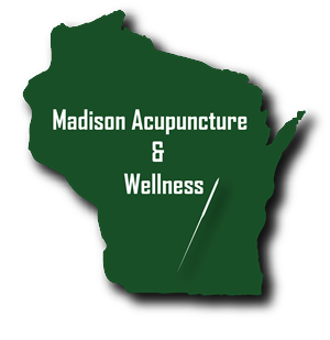 Logo Design by JuneS