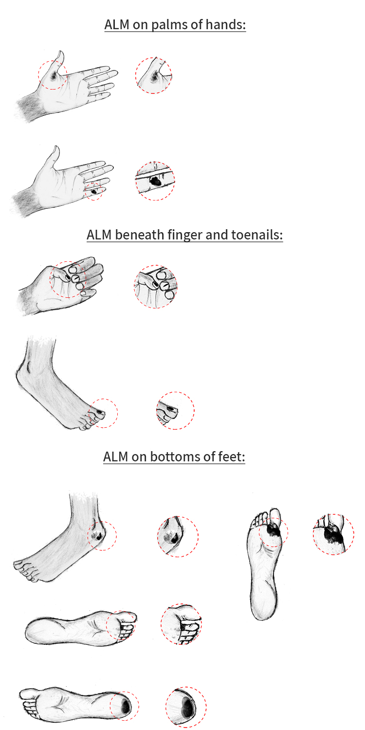 Illustration Design by King Cozy for University of utah | Design #21430938