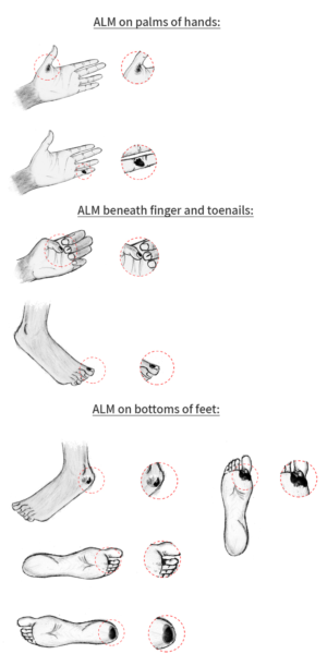 Illustration Design by King Cozy for University of utah | Design: #21430938