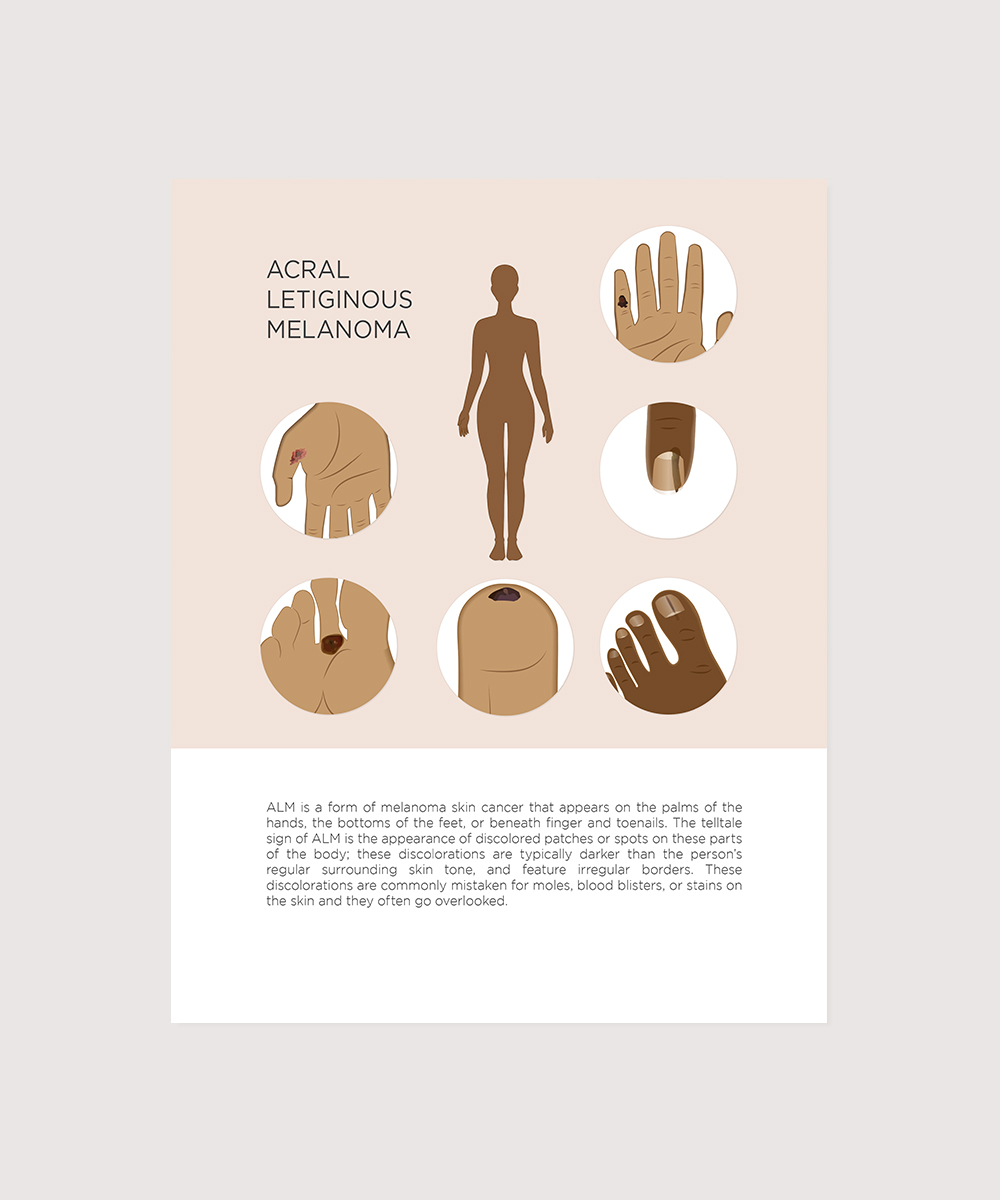 Illustration Design by senja for University of utah | Design #21445795