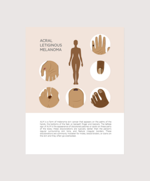 Illustration Design by senja for University of utah | Design: #21445795