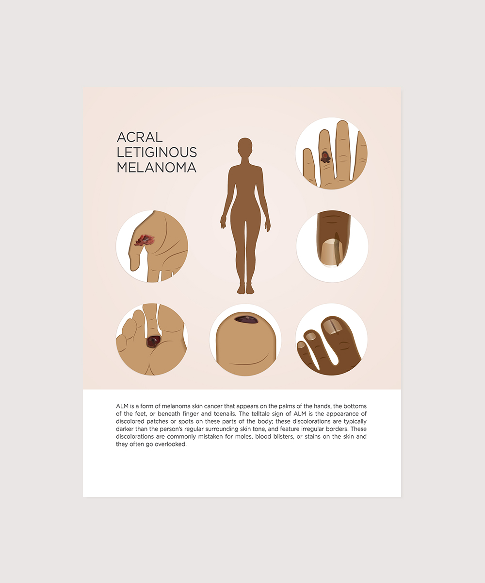 Illustration Design by senja for University of utah | Design #21477060