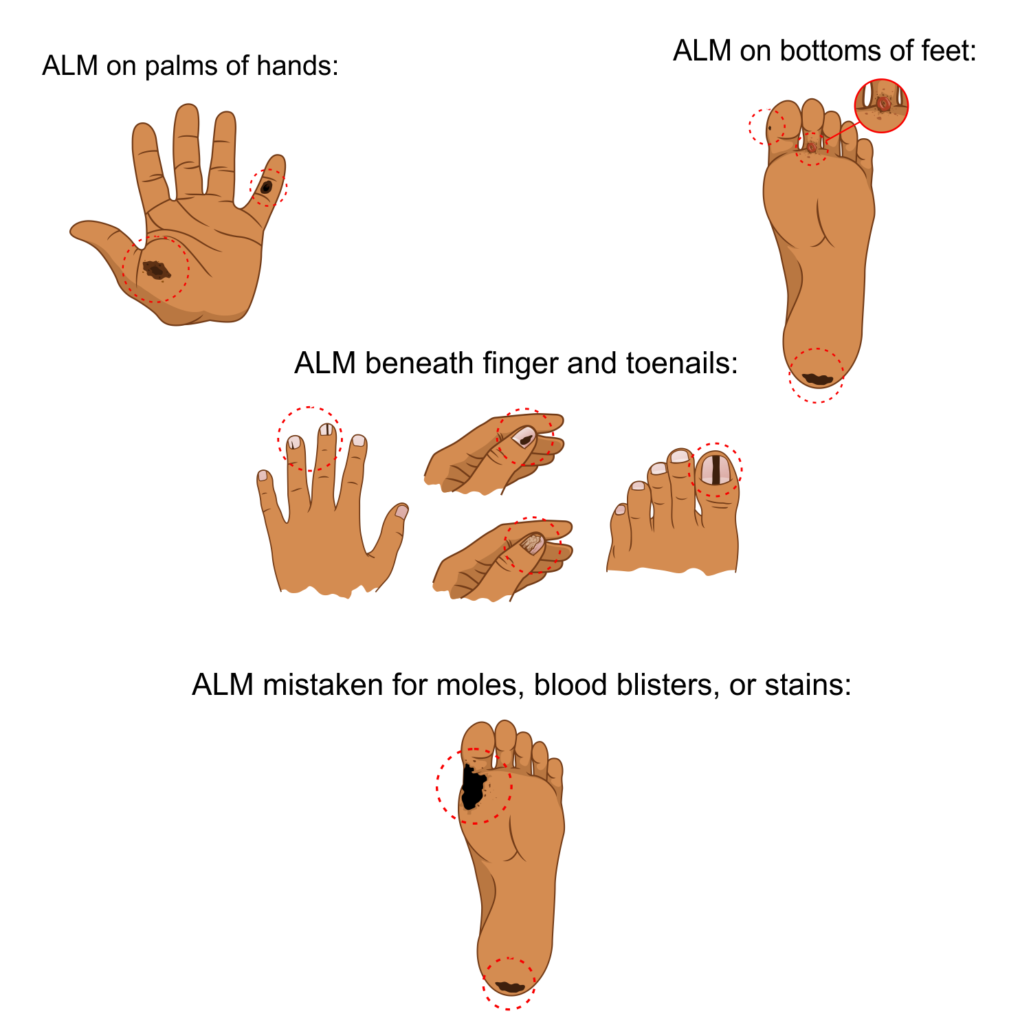 Illustration Design by alpino for University of utah | Design #21408460