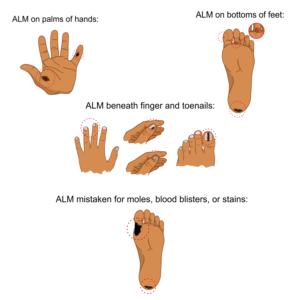 Illustration Design by alpino for University of utah | Design: #21408460