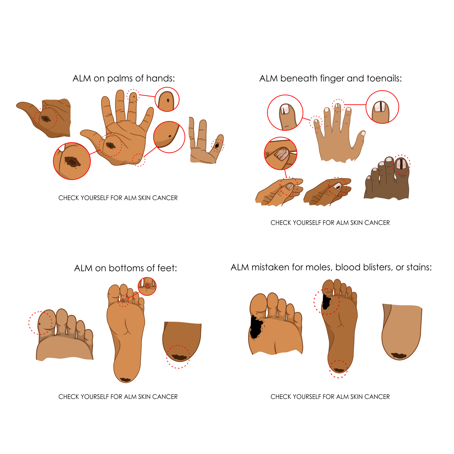 Illustration Design by alpino for University of utah | Design #21424781