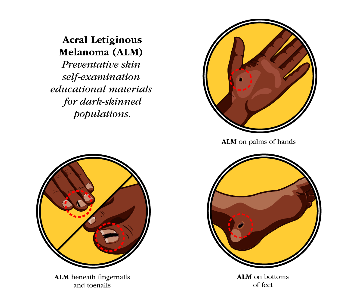 Illustration Design by GliderGraphx for University of utah | Design #21448900