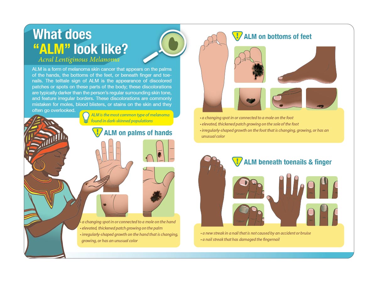 Illustration Design by ArtTank for University of utah | Design #21472798